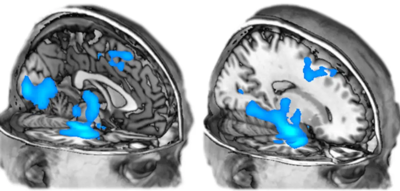 Read more about the article Magic Mushrooms Could Rewire Your Brain to Reduce Depression and Anxiety